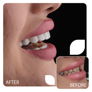 کامپوزیت (2)