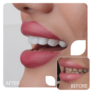 کامپوزیت (3)