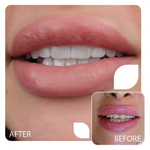 کامپوزیت (7)