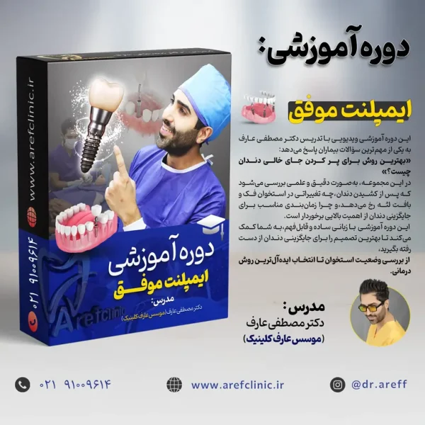 دوره آموزشی ایمپلنت موفق