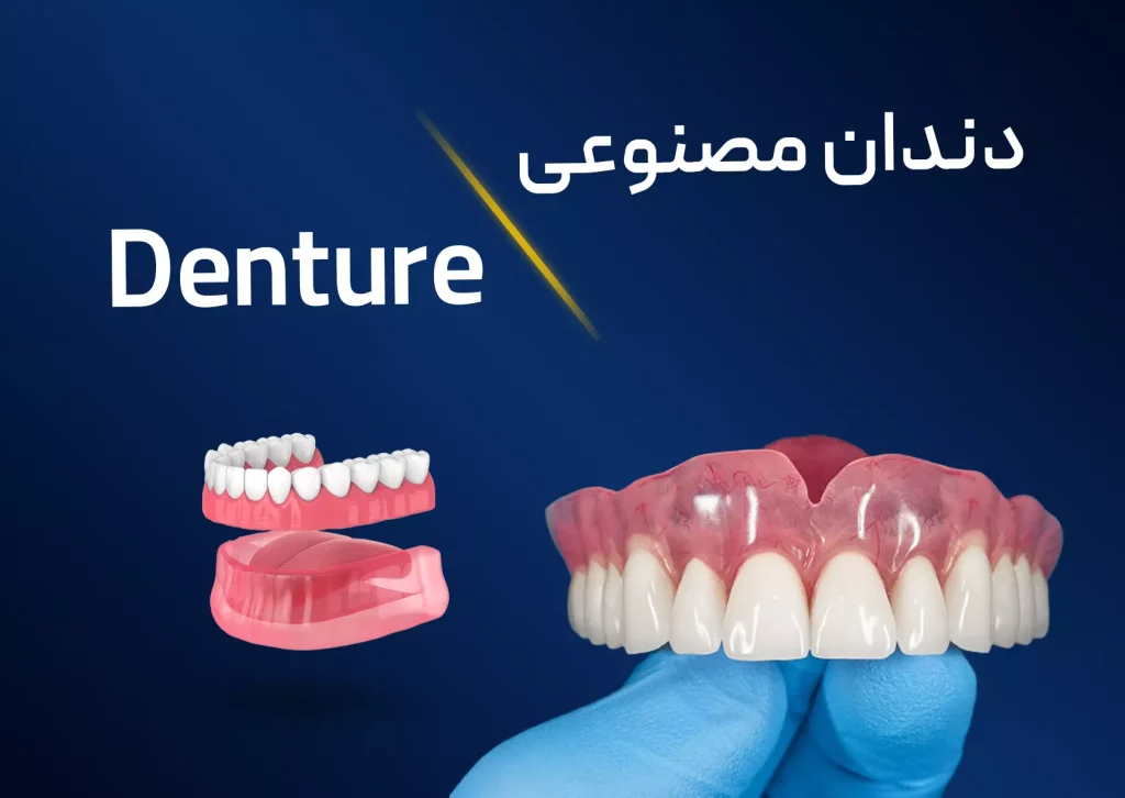 بهترین مرکز دندان مصنوعی